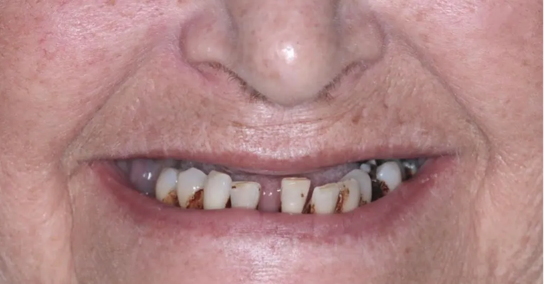 alt1