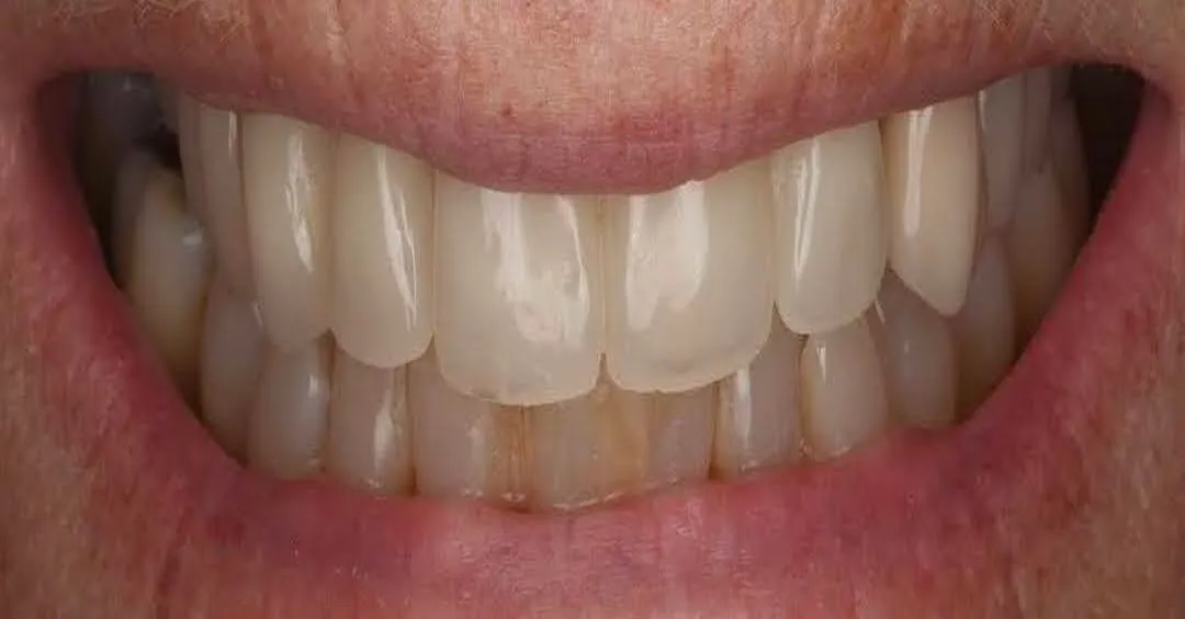 alt1